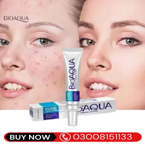  ANTI ACNE CREAM in Pakistan